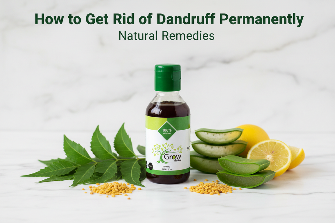 How to Get Rid of Dandruff Permanently — Natural Remedies That Actually Work